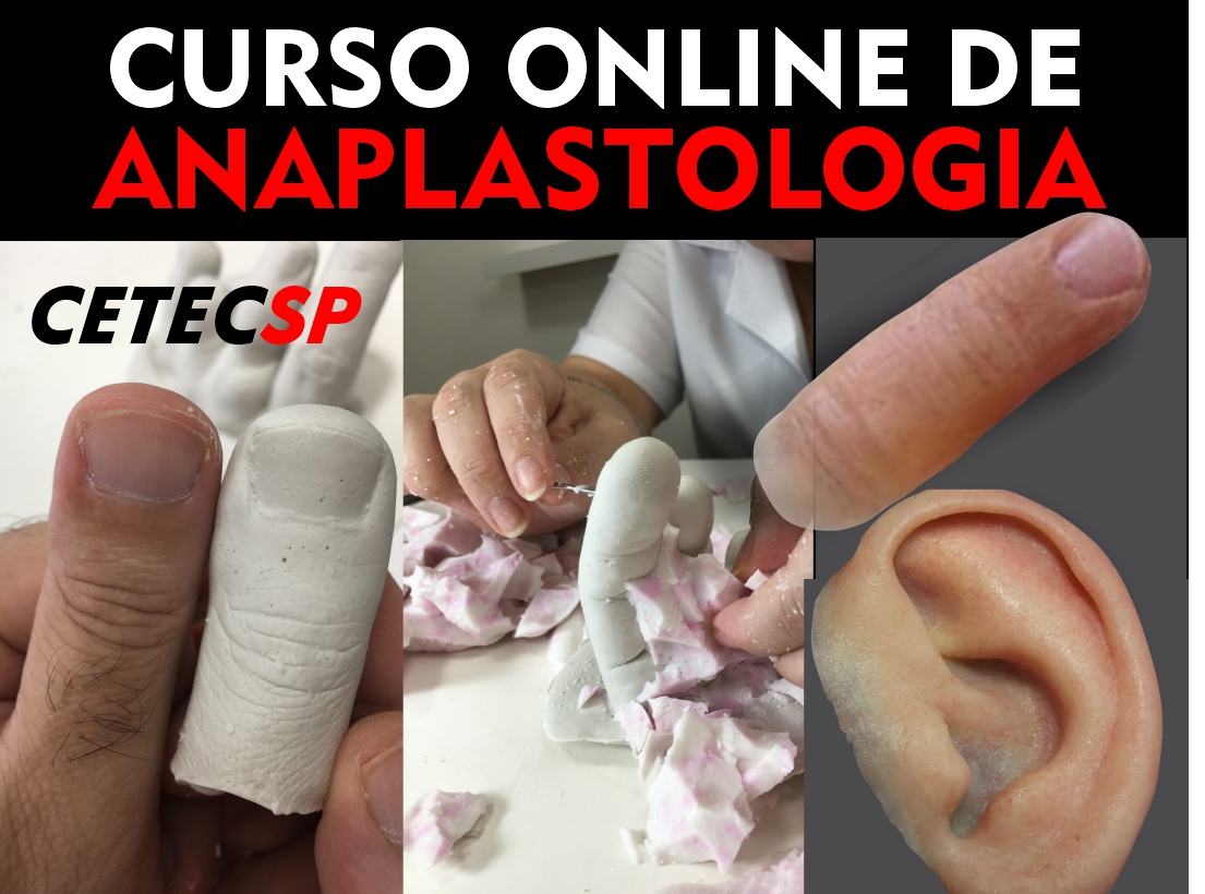 CAPA CURSO ANAPLASTOLOGIA